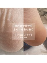 ララルアナ(Lara luana)/ガサガサ踵のケア