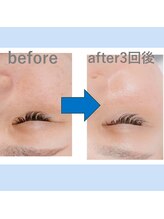 ミアローザ(Mia Rosa)/モチモチ美肌へ