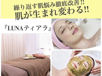 ルナティアラ(LUNAティアラ)の写真