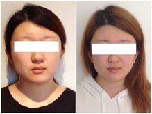 ウェリナ 一宮院/小顔矯正/骨盤矯正/痩身整体