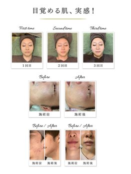 ディアント(DIANT)/