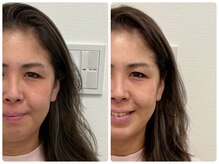 KTYフェイスジム 名古屋栄店(KTY FACE GYM)/初回1回目から効果◎