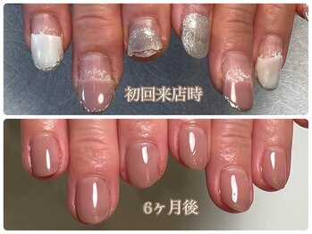 ルドネ ヴィ アシヤ(Redonner vie Ashiya)/傷んだ爪を健康な爪に育爪コース