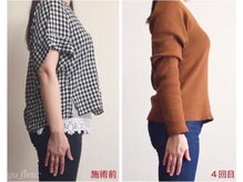 ユーフルール/ニットが着られるように＾＾