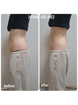 ヒーリングヘッドストーリー(healing head story)/腸もみ、腸もみヘッドスパ