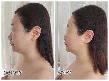 オリ(ORI)/ラジオ×リリース×レモン１回で