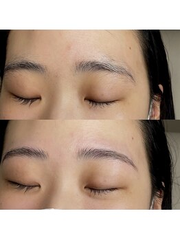 ネネ(nene.)/Hollywood brow lift