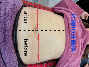 マハロ スコータイ/ビフォーアフター　＜お腹＞