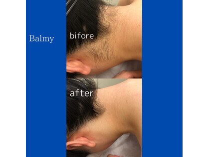 バルミー(Balmy)の写真
