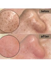 ティティビュティ 一宮駅前店(TTBeauty)/変化に驚く…