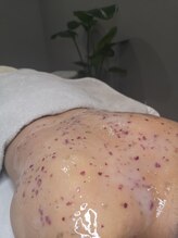 ハウオリ スパ(Hau’Oli Spa)/背中ハイドロジェリーマスク