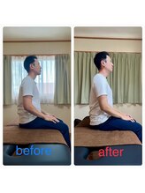 花巻ひふみ整骨院/猫背姿勢の改善（男性）