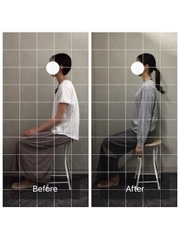 博多おかげ整体院/ストレートネック改善◎