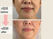 ウィッシュプロサロンケー(WISHpro salon K)