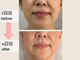 ウィッシュプロサロンケー(WISHpro salon K)の写真
