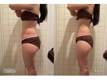 アネル 新都心店(anel)/