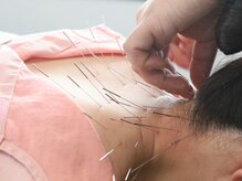 ゆたか鍼灸院の雰囲気（《ルート鍼導入》蓄積された「コリ」に集中アプローチ!!）