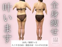 ベベティー(BEBETIE)/天使の羽誕生☆全身サイズダウン