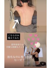 ジーニー(Genie)/全身脱毛