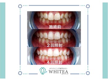 ホワイティア 東金店(WHITEA)