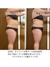 ヨサパーク リバティ 池袋東口店(YOSA PARK Liberty)/Before&After