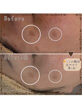 プライベートサロン レイ(Ray)/小顔コース＋くまケアアロマ背中