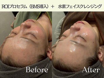 ロイボーテ(ROI Beaute)/よみがえるツヤ肌