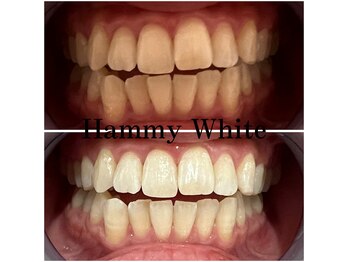 ハミーホワイト(Hammy White)