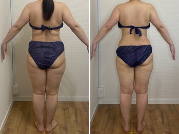 カプリス(CAPRiCE)/リンパドレナージュ