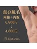 メンズ【両腕+両脇脱毛セット】+美肌ジェル　¥6800→期間限定¥4800