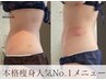 ≪本格痩身≫ハイパーナイフEX＋セル脂肪潰しマシン＋強圧リンパ＋骨盤矯正