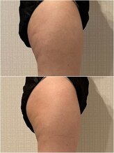 シェリール(CHIRIEUR)/ヒップアップ