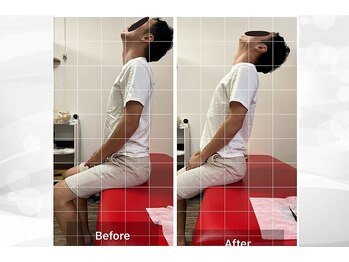 ナオル整体 浦添院(NAORU整体)/沖縄県/浦添/肩こり/整体/腰痛