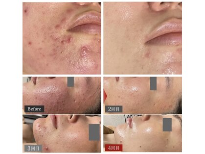 エステティック バイ イム(esthetic by im)の写真