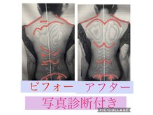 新リンパサロン 大阪の雰囲気（巻き肩が改善され姿勢もよくなり、全体的にスッキリされました！）