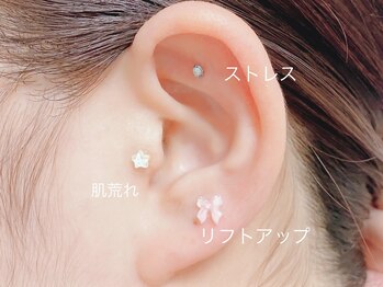 リノア(Linoa)/耳つぼジュエリー両耳6粒まで