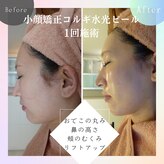 スイートボイス(sweet voice)