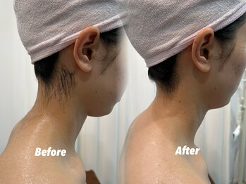 クイーン 渋谷店(QUEEN)/髪の毛アップにするなら