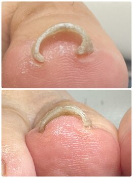 スマイルニコ(smile nico)/