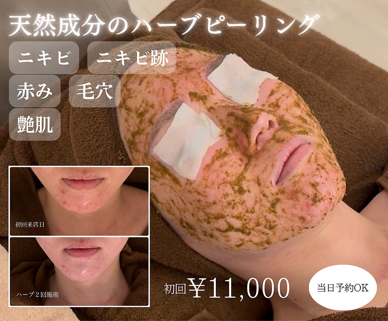 23ビューティー(23beauty)｜ホットペッパービューティー
