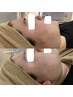 【美白/ハリ/乾燥】磁気パックで白肌つるり復元ケア