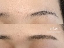 アノカプイル(ankpil)/【お得な垢抜けセット】