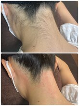 エン(en.)/BeforeAfter写真18