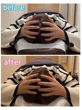 スカイ 鍼灸整骨院 整体院(SKY)/小顔矯正