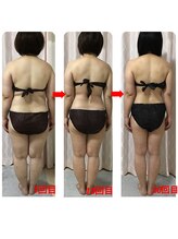 トロイカ 天王寺店(troika)/全身メディセル20回/40代後半