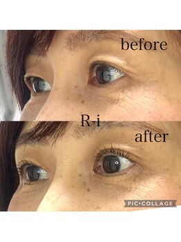 アールアイ(R-i)/アイリッドアップパーマ