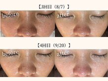 ドリームスパ 武蔵小杉店(DREAM SPA)/before→after