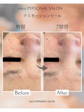 トイロ(toiro)/ラミネーションピール