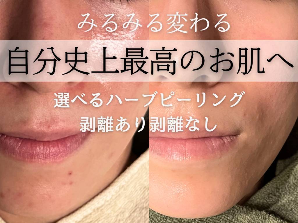 ジプソフィラフィフティドット(gypsophira15.)｜ホットペッパー