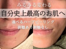 ジプソフィラフィフティドット(gypsophira15.)